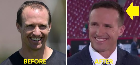 Drew brees makes his nbc debut, internet amazed by his new hair